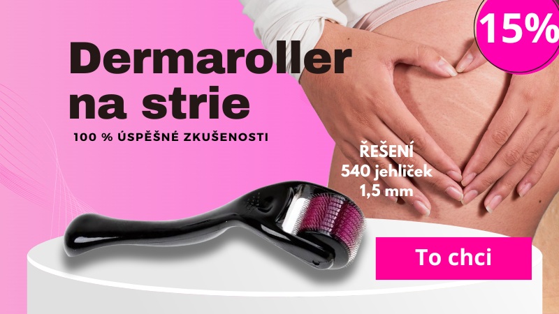 Dermaroller strie na stehnách – 540 jehliček, 1,5 mm, účinné řešení pro redukci strií, 100% úspěšné zkušenosti, 15% sleva.
